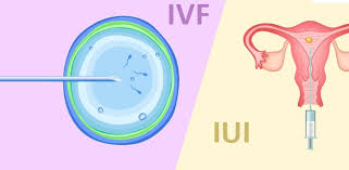 IUI और IVF में क्या फर्क है? र‍िसर्च से समझें क‍िन कंडीशन में कौन से फर्टिलिटी ट्रीटमेंट की पड़ती है जरूरत