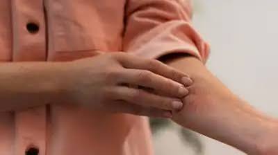 ज्यादा चिंता करने से शरीर पर निकलते हैं लाल चकत्ते, टेंशन और स्ट्रेस लेने वाले हो जाएं सावधान